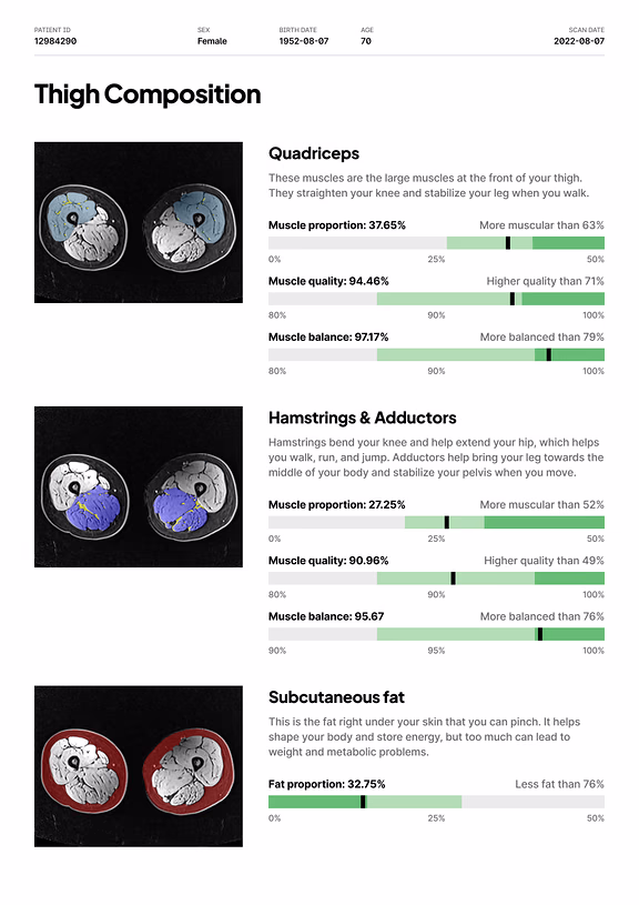 Report page: thigh composition, with quadriceps, hamstrings and adductors, and subcutaneous fat