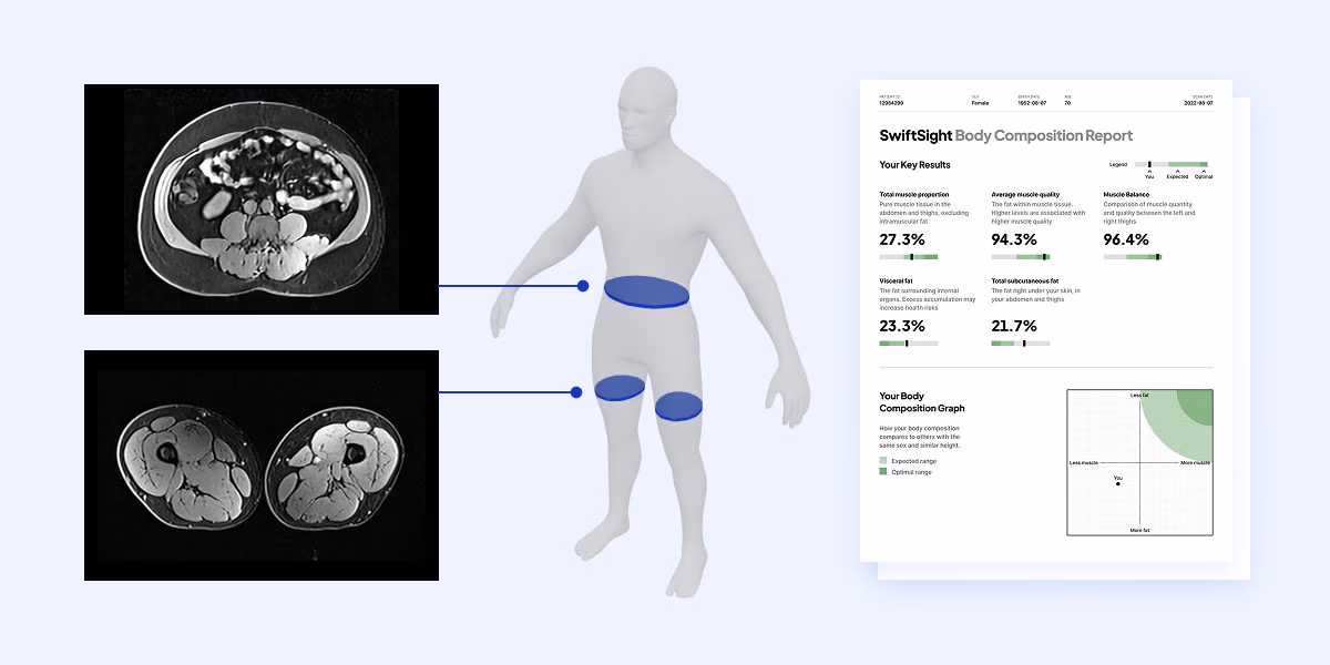 SwiftSight Body Composition report showing muscle and fat measurements at the abdomen and mid-thigh