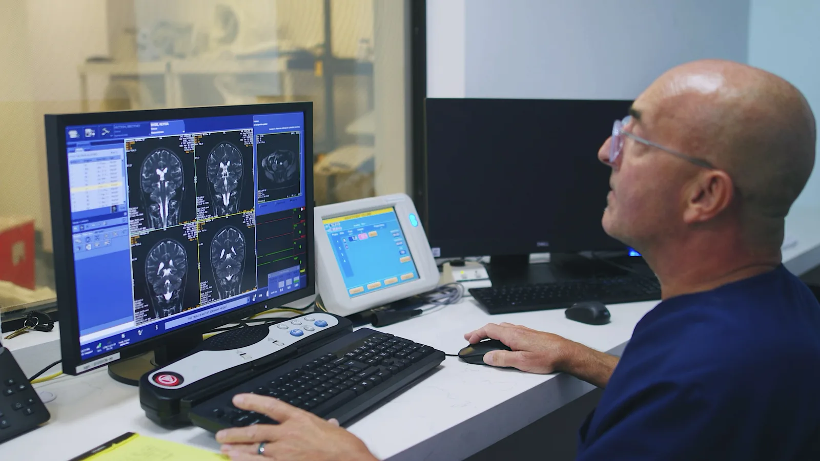 A SimonMed technologist at the scanner console reviews brain MRI images on the monitor